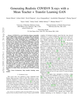 Generating Realistic COVID19 X-rays with a Mean Teacher + Transfer
  Learning GAN