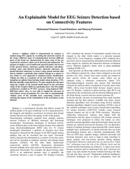 An Explainable Model for EEG Seizure Detection based on Connectivity
  Features