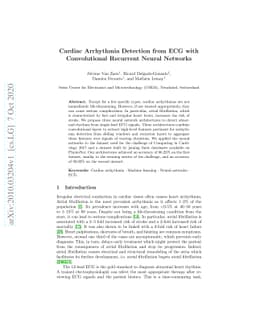 Cardiac Arrhythmia Detection from ECG with Convolutional Recurrent
  Neural Networks