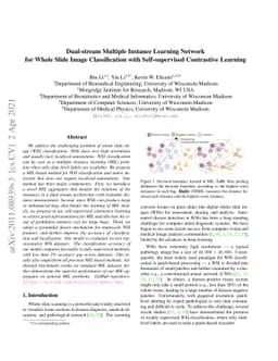 Dual-stream Multiple Instance Learning Network for Whole Slide Image
  Classification with Self-supervised Contrastive Learning