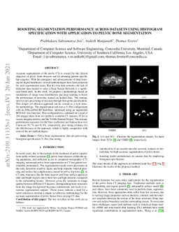 Boosting Segmentation Performance across datasets using histogram
  specification with application to pelvic bone segmentation