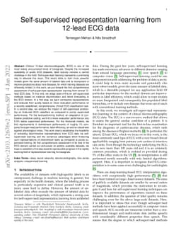 Self-supervised representation learning from 12-lead ECG data