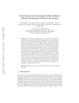 Semi-Supervised Learning for Bone Mineral Density Estimation in Hip
  X-ray Images