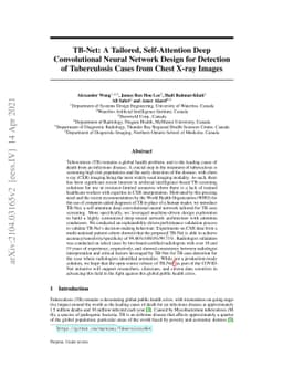 TB-Net: A Tailored, Self-Attention Deep Convolutional Neural Network
  Design for Detection of Tuberculosis Cases from Chest X-ray Images
