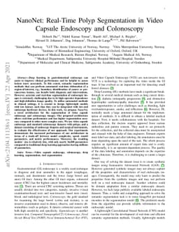NanoNet: Real-Time Polyp Segmentation in Video Capsule Endoscopy and
  Colonoscopy
