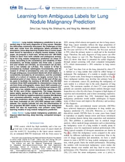 Learning from Ambiguous Labels for Lung Nodule Malignancy Prediction