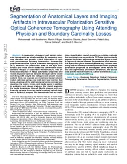 Segmentation of Anatomical Layers and Artifacts in Intravascular
  Polarization Sensitive Optical Coherence Tomography Using Attending Physician
  and Boundary Cardinality Losses