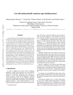 Can self-training identify suspicious ugly duckling lesions?