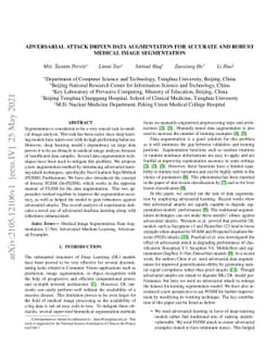 Adversarial Attack Driven Data Augmentation for Accurate And Robust
  Medical Image Segmentation