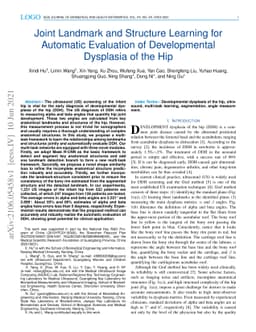 Joint Landmark and Structure Learning for Automatic Evaluation of
  Developmental Dysplasia of the Hip