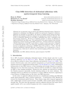 Cine-MRI detection of abdominal adhesions with spatio-temporal deep
  learning