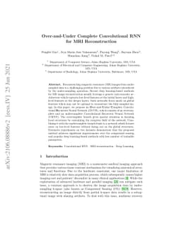 Over-and-Under Complete Convolutional RNN for MRI Reconstruction