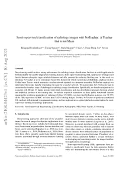 Semi-supervised classification of radiology images with NoTeacher: A
  Teacher that is not Mean