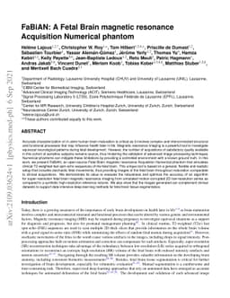 FaBiAN: A Fetal Brain magnetic resonance Acquisition Numerical phantom
