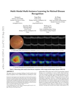 Multi-Modal Multi-Instance Learning for Retinal Disease Recognition