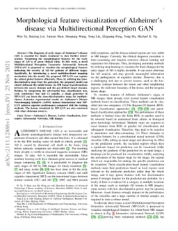 Morphological feature visualization of Alzheimer's disease via
  Multidirectional Perception GAN