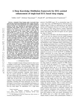 A Deep Knowledge Distillation framework for EEG assisted enhancement of
  single-lead ECG based sleep staging