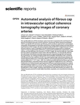 Automated analysis of fibrous cap in intravascular optical coherence
  tomography images of coronary arteries