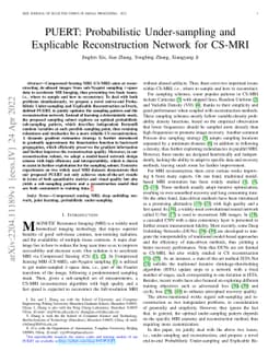 PUERT: Probabilistic Under-sampling and Explicable Reconstruction
  Network for CS-MRI