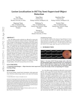 Lesion Localization in OCT by Semi-Supervised Object Detection