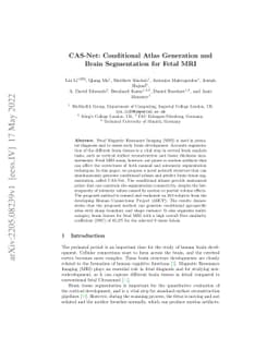 CAS-Net: Conditional Atlas Generation and Brain Segmentation for Fetal
  MRI