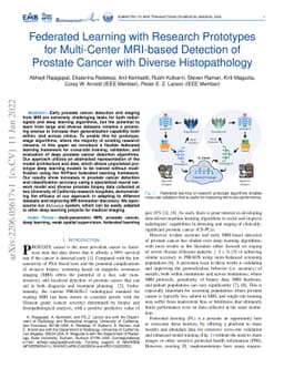 Federated Learning with Research Prototypes for Multi-Center MRI-based
  Detection of Prostate Cancer with Diverse Histopathology