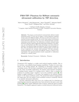 PRO-TIP: Phantom for RObust automatic ultrasound calibration by TIP
  detection