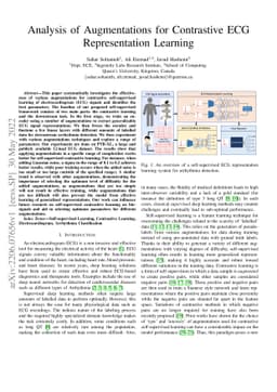 Analysis of Augmentations for Contrastive ECG Representation Learning