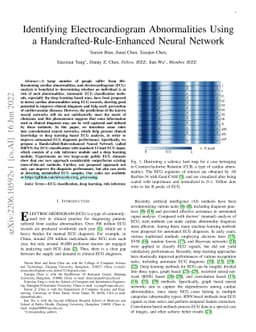 Identifying Electrocardiogram Abnormalities Using a
  Handcrafted-Rule-Enhanced Neural Network