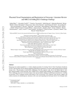 Placental Vessel Segmentation and Registration in Fetoscopy: Literature
  Review and MICCAI FetReg2021 Challenge Findings