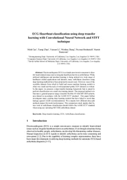 ECG Heartbeat classification using deep transfer learning with
  Convolutional Neural Network and STFT technique