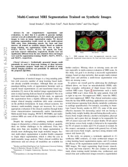 Multi-Contrast MRI Segmentation Trained on Synthetic Images