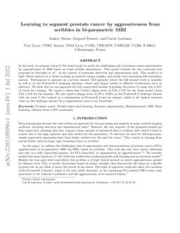 Learning to segment prostate cancer by aggressiveness from scribbles in
  bi-parametric MRI