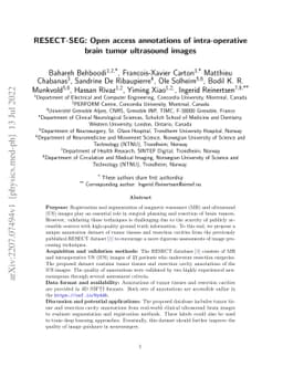 RESECT-SEG: Open access annotations of intra-operative brain tumor
  ultrasound images
