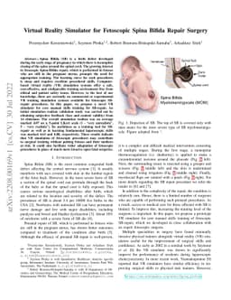 Virtual Reality Simulator for Fetoscopic Spina Bifida Repair Surgery