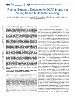 Retinal Structure Detection in OCTA Image via Voting-based Multi-task
  Learning