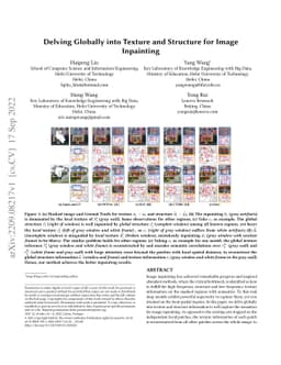 Delving Globally into Texture and Structure for Image Inpainting
