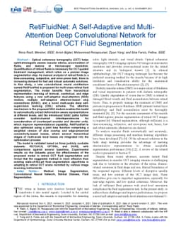 RetiFluidNet: A Self-Adaptive and Multi-Attention Deep Convolutional
  Network for Retinal OCT Fluid Segmentation