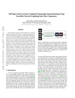 Self Supervised Low Dose Computed Tomography Image Denoising Using
  Invertible Network Exploiting Inter Slice Congruence