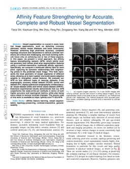 Affinity Feature Strengthening for Accurate, Complete and Robust Vessel
  Segmentation