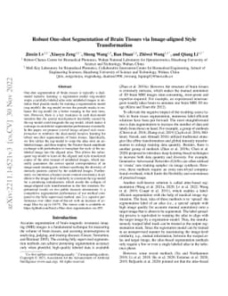 Robust One-shot Segmentation of Brain Tissues via Image-aligned Style
  Transformation