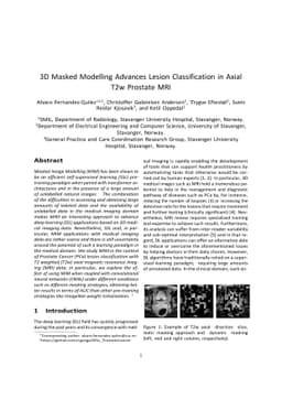 3D Masked Modelling Advances Lesion Classification in Axial T2w Prostate
  MRI