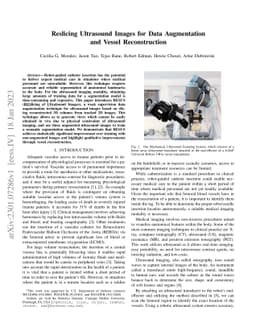 Reslicing Ultrasound Images for Data Augmentation and Vessel
  Reconstruction