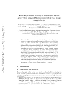 Echo from noise: synthetic ultrasound image generation using diffusion
  models for real image segmentation