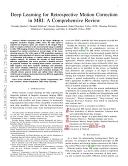 Deep Learning for Retrospective Motion Correction in MRI: A
  Comprehensive Review