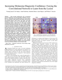Increasing Melanoma Diagnostic Confidence: Forcing the Convolutional
  Network to Learn from the Lesion