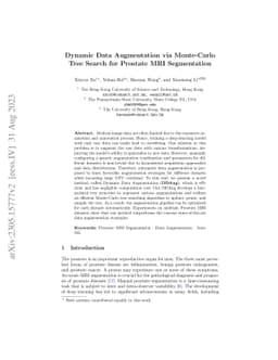 Dynamic Data Augmentation via MCTS for Prostate MRI Segmentation