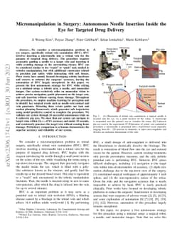 Micromanipulation in Surgery: Autonomous Needle Insertion Inside the Eye
  for Targeted Drug Delivery