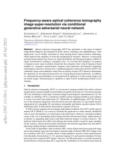 Frequency-aware optical coherence tomography image super-resolution via
  conditional generative adversarial neural network