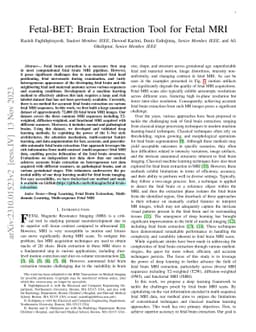 Fetal-BET: Brain Extraction Tool for Fetal MRI